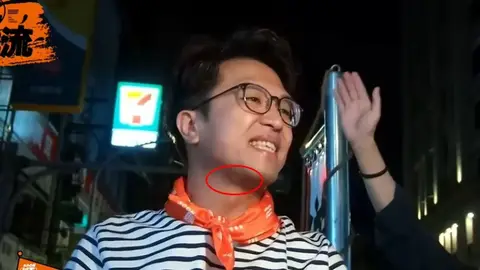 沈伯洋脖子冒凸起物引發熱議 醫師分析三種可能狀況
